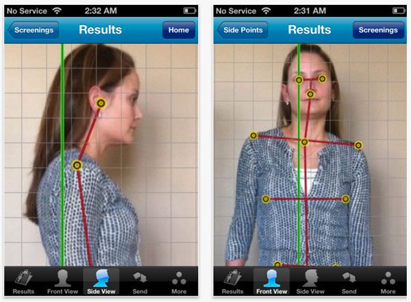 Detecting postural misalignments and distortion patterns